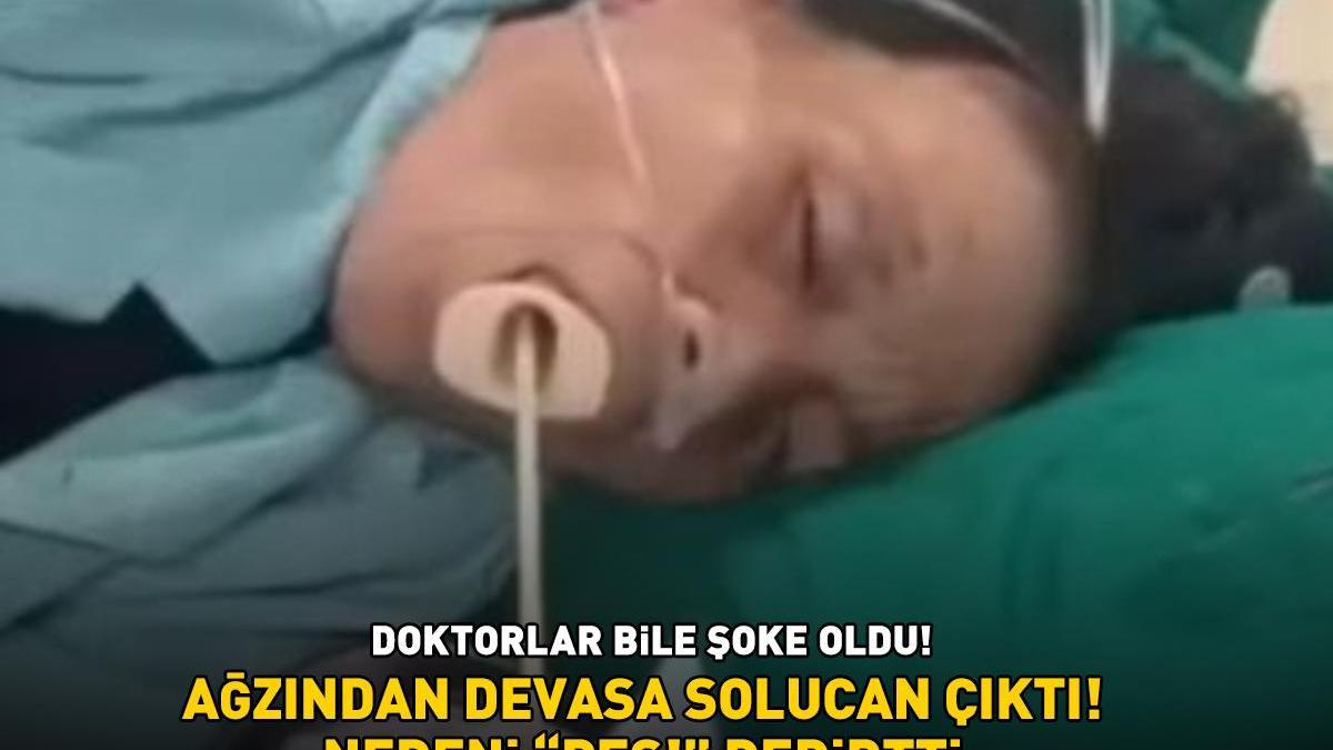 Doktorlar bile şoke oldu! Ağzından devasa solucan çıktı! Nedeni ‘Pes!’ dedirtti
